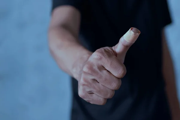 Мужчина Накладывает Повязку Клеевую Штукатурку Палец Большого Пальца Штукатурка Ране — стоковое фото