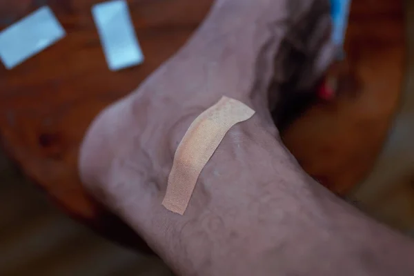 다리의 부상당 피부에 — 스톡 사진