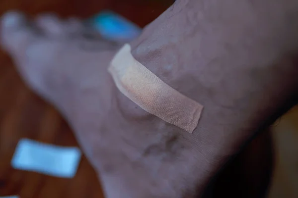 Adhesive plaster on the injured skin of a man\'s leg.