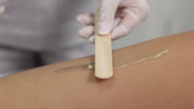 Saç aldırma kozmetoloji prosedürü. Lazer epilasyon ve kozmetoloji