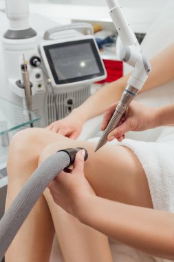 Güzellik salonunda lazer epilasyon aletleri. Donanım kozmetolojisi