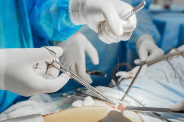 Surgery and emergency concept. Professional Medical Doctors Performing Surgery