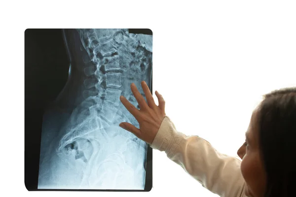 Doctor observing lumbar displacement in patient with congenital scoliosis in lateral view human anatomy in spindle view