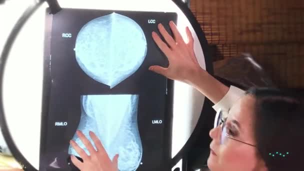 Kvinna Läkare Undersöker Ljuslåda Röntgenstudie Som Kallas Mastografi För Att — Stockvideo