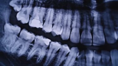 X-ray image of the jaw of all human teeth close-up. Magnetic resonance imaging of teeth. The doctor examines the x-ray of the tooth. Health care and medicine, dentistry, dentistry concept.