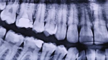 X-ray image of the jaw of all human teeth close-up. Magnetic resonance imaging of teeth. The doctor examines the x-ray of the tooth. Health care and medicine, dentistry, dentistry concept.