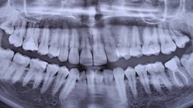 X-ray image of the jaw of all human teeth close-up. Magnetic resonance imaging of teeth. The doctor examines the x-ray of the tooth. Health care and medicine, dentistry, dentistry concept.