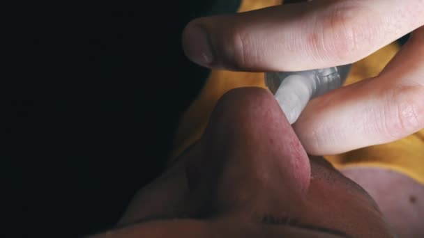 男人用一种特殊的喷雾特写滴下他的红鼻子 一个病人流鼻涕 病毒感染 家庭治疗 — 图库视频影像