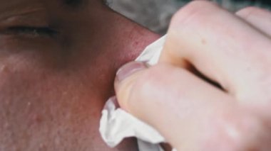 Kırmızı burunlu bir adam burnunu yakın plan beyaz bir peçeteye sildi. Hasta bir insan burnunun akmasından muzdarip. Viral enfeksiyon. Sağlık hizmetleri. Ev tedavisi.