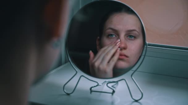 Jonge Mooie Vrouw Ongelukkig Met Haar Spiegelbeeld Probleem Met Acne — Stockvideo