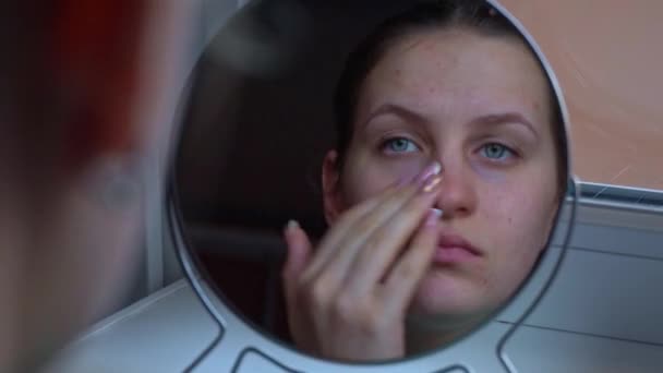 Молодая Красивая Женщина Недовольна Своим Отражением Зеркале Проблема Прыщами Лице — стоковое видео