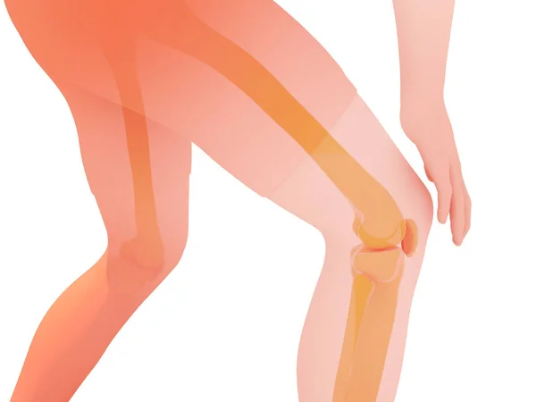 Illustration Anatomy Knee Pain Transparent Image Bones White Background — Fotografia de Stock