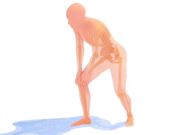 Illustration Anatomy Knee Pain Transparent Image Bones White Background —  Fotos de Stock