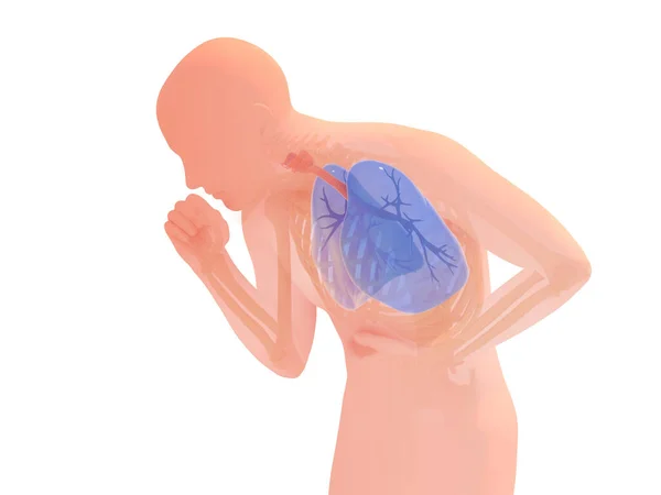 Illustration Human Silhouette Coughing Crouching Showing Internal Organs Highlighting Respiratory — Photo