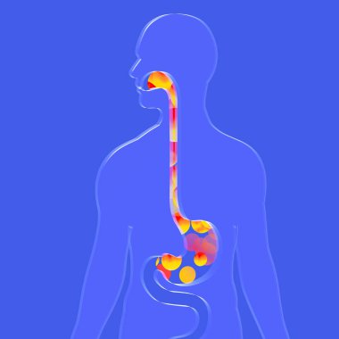 Gastrik reflü ve mide ekşimesi olan 3 boyutlu yemek borusu çizimi. Ateş toplarıyla. Sindirim sistemi ve mavi arka planda saydam camdan yapılmış insan silueti..