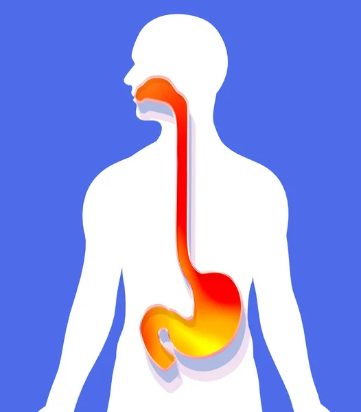 Illustration Stomach Esophagus Mouth Fire Indigestion Showing Digestive System Cutout — Stock Photo, Image