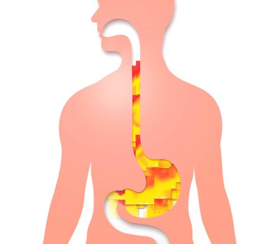 Gastrik reflü ve mide ekşimesi olan 3 boyutlu yemek borusu çizimi. Düz ateş kareleri yukarı doğru hareket ediyor. Beyaz arkaplanda sindirim sistemi ve insan silueti.