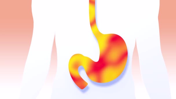 3D动画的胃和食道与火 燃烧和回流 在白色背景下显示人体消化系统的解剖内部 — 图库视频影像