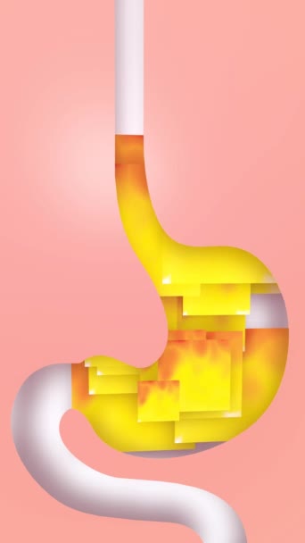 中の火の長方形の胃の3Dアニメーション 上昇する バーニングとリフレックス 白い背景に人間の消化器系 — ストック動画