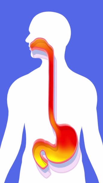 Animation Estomac Œsophage Bouche Avec Feu Reflux Indigestion Affichage Système — Video