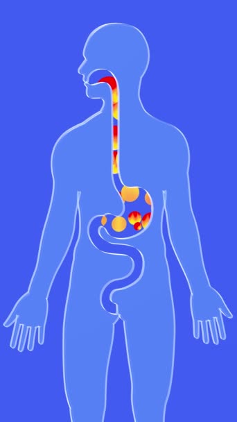 3D动画食管和胃与胃反流和燃烧 火圈向上移动 用蓝色背景透明玻璃制成的消化系统和人体轮廓 — 图库视频影像