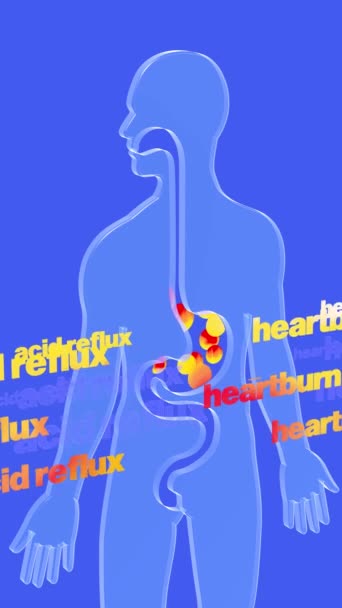 3D动画食管和胃与胃反流和燃烧 火圈的特点和 酸倒流 心灼热 这两个字向上移动 蓝底透明玻璃消化系统 — 图库视频影像