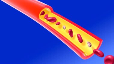 Yağ tıkanıklığı olan yetersiz arterin anatomik 3 boyutlu animasyonu. Kan dolaşımı zayıf. Alyuvar ve trombosit dolaşımı zayıf. Mavi arkaplanda kesme kılcal damarı.