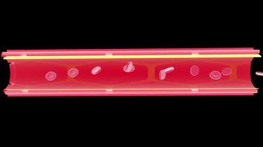Atardamarın anatomik iç kısmının 3 boyutlu animasyonu. Yağ birikimi, kırmızı kan hücrelerinin birikmesini engeller ve trombüs oluşturur. Siyah arkaplanda kılcal damar.