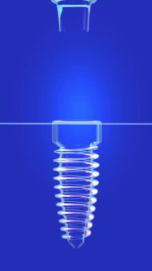 Şeffaf cam grafik tarzında bir diş implantının dikey üç boyutlu animasyonu. Dahili ışıklandırmayla. Sakızın içine yerleştirme eylemini gösteriyor.