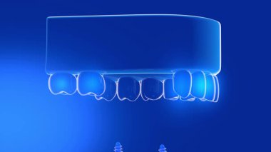 Şeffaf cam bir sakıza yerleştirilen çift implantın 3 boyutlu animasyonu. Üç dişli implant. Şeffaf iç mekanı ışıklarla gösteriyor. Mavi bir arkaplanda.