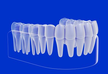 Takma dişin beyaz ve şeffaf grafik şeklinde üç boyutlu çizimi. Tüm dişlerini gösteriyor. Mavi arka plandaki cam sakıza yerleştirilmiş, iç mekanı gösteriyor..