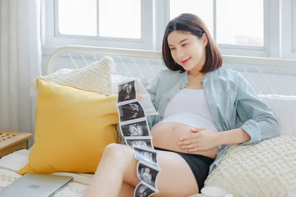 Young Asian Happy Pregnant Woman Holding Ultrasound Scan Image Touching — Stockfoto