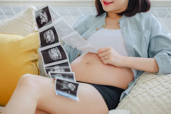 Young Asian Happy Pregnant Woman Holding Ultrasound Scan Image Touching — Stockfoto