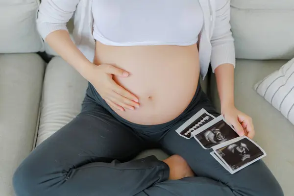 Close Crop Asian Pregnant Woman Holding Ultrasound Scan Image Touching — Stock Photo, Image
