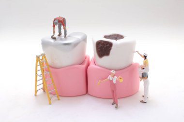 Bir minyatür işçi diş modelini temizler ve düzeltir.