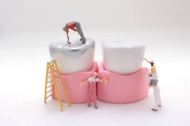 Bir minyatür işçi diş modelini temizler ve düzeltir.