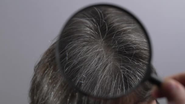皮肤科医生用放大镜检查伊玛目的头发 — 图库视频影像