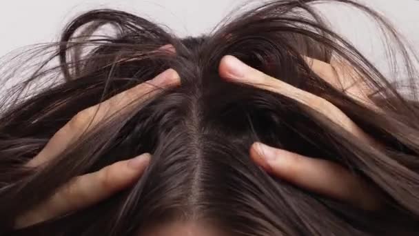 Wanita Menggaruk Kulit Kepala Gatal Pada Latar Belakang Putih — Stok Video