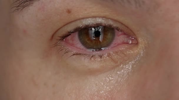 Gråtande Mannen Med Tårar Face Närbild — Stockvideo