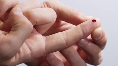 Tıbbi test sırasında parmak ucundaki kan damlası glikoz izleme, teşhis ve rutin sağlık prosedürlerini sembolize eder..