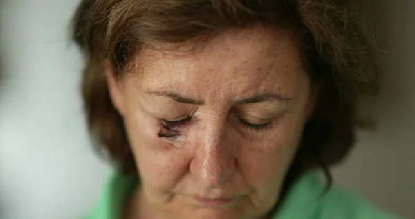 Sad depressed older woman with scar looking down