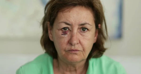 Bruised older woman with scar looking to camera with sad emotion