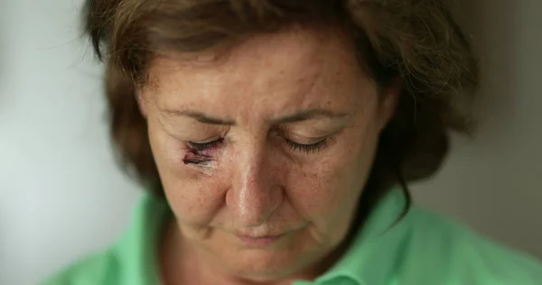 Older woman with scarred bruised face looking to camera suffering