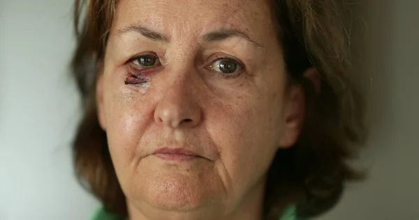 Older woman with beaten face and with scar shaking head with disapproval