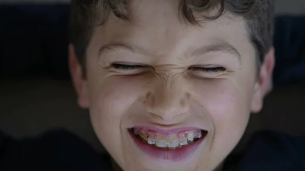 Cara Menino Pequeno Feliz Closeup Sorrindo Com Aparelho Autêntico Sorriso — Fotografia de Stock