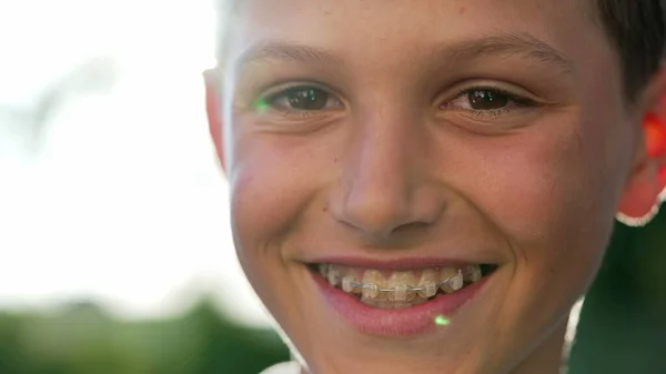 Glad Ung Pojke Ler Mot Kameran Närbild Porträtt Ansikte Preteen — Stockfoto