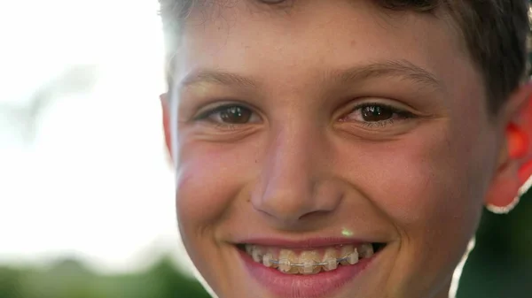 Один Счастливый Мальчик Улыбается Камеру Закрыть Портретное Лицо Ребенка Подростка — стоковое фото