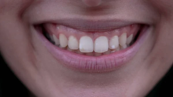Makro Uśmiechem Ustach Kobiety Ekstremalne Zbliżenie Dorosłych Dziewczyn Usta Zęby — Zdjęcie stockowe