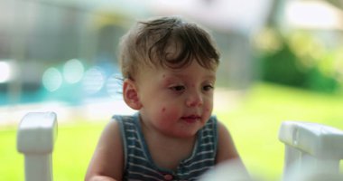 Yaz günü arka bahçede sevimli bir bebek var. Sivrisinek ısırığıyla kaplı bebek yüzü.