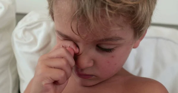 Dziecko Drapie Się Oku Czuje Zmęczenie Przystojny Blond Maluch Chłopiec — Zdjęcie stockowe